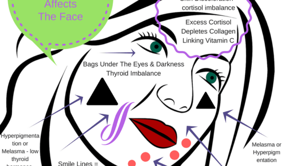 how hormone imbalance affects the face