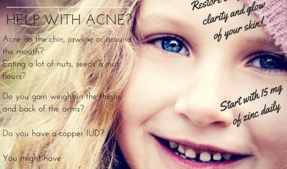 Can Zinc Help With Acne